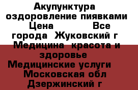 Акупунктура, оздоровление пиявками › Цена ­ 3 000 - Все города, Жуковский г. Медицина, красота и здоровье » Медицинские услуги   . Московская обл.,Дзержинский г.